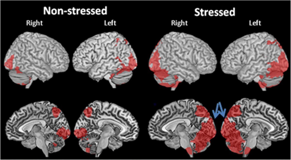 Thumbnail of www-x-com-hussainibarra-status-1850112259323830613-bee3e6667bb04e5d