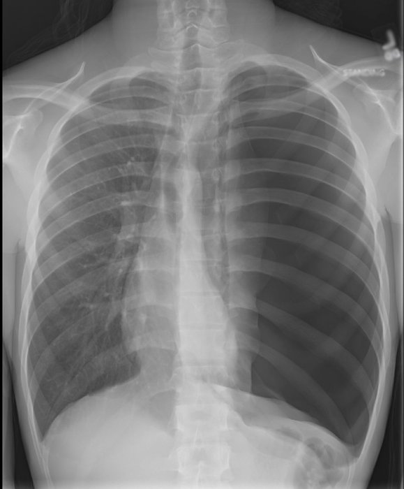 Thumbnail of www-x-com-em-resus-status-1850651769753239814-d7e217ba75f74d50
