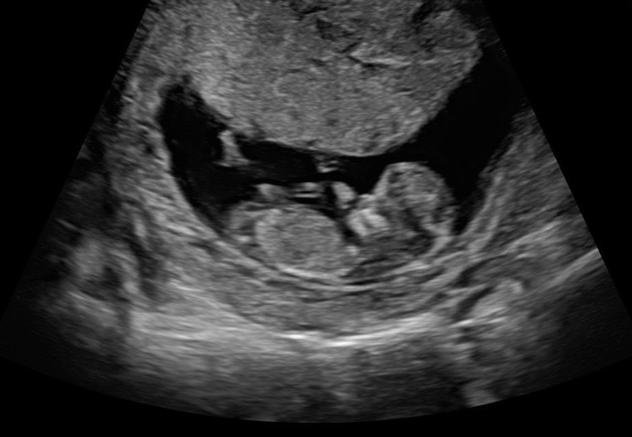 Thumbnail of www-x-com-pronatalism-status-1391814129103540225-ed7cd6a3a4224fb3