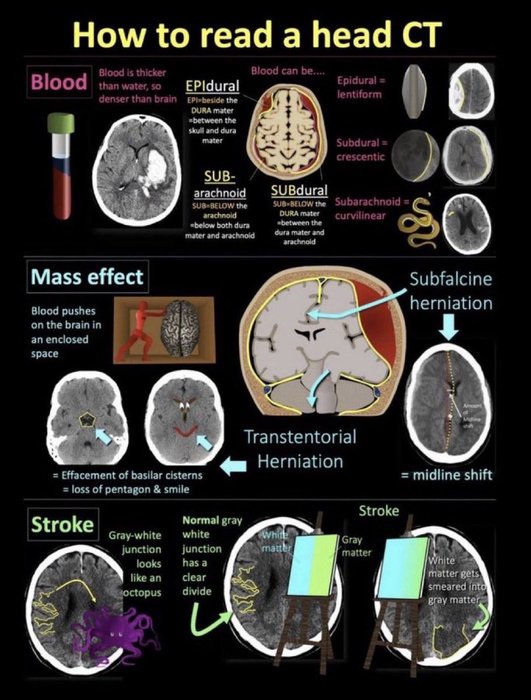 Thumbnail of www-x-com-brownjhm-status-1829956345191145550-f2efcbb1733f426f