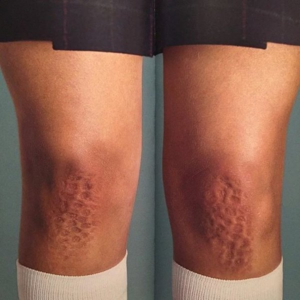 Preview of raoovkyr-jpeg