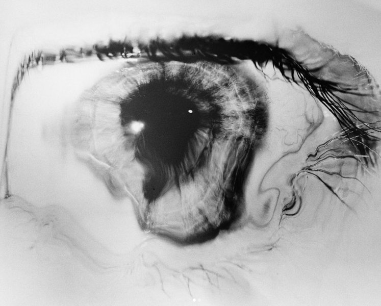 Thumbnail of Image