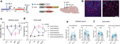 Thumbnail of First stroke rehabilitation drug that reestablishes brain connections discovered in mouse model