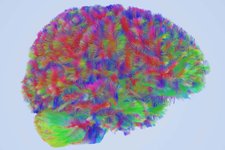 Thumbnail of Your brain undergoes four dramatic periods of change from age 0 to 90