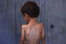 Thumbnail of Gaza is starving. Where are the American Jewish leaders?