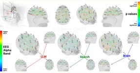 Thumbnail of ChatGPT's Impact On Our Brains According to an MIT Study