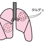 Thumbnail of ãƒ‘ãƒ«ã‚¿ã‚¦ãƒ•æ–‘ã�¨ã‚¿ãƒ«ãƒ‡ãƒ¥ãƒ¼æ–‘