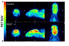 Thumbnail of Nervous system activity might influence human longevity, neural activity