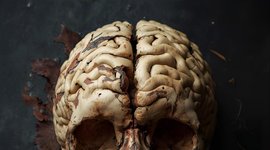 Thumbnail of An antidote to brain rot (according to a neuroscientist)