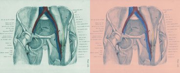 Thumbnail of It’s the Most Important Muscle in Your Body and You Don’t Even Know What It’s Called