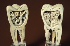 Thumbnail of 5000 BC