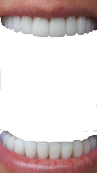 Preview of pin-6051780745827585