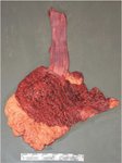 Thumbnail of Internal Examination - Water-Related Death Investigation: Practical Methods and Forensic Applications