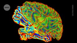 Thumbnail of ‘Mind-captioning’ AI decodes brain activity to turn thoughts into text