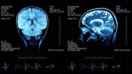 Thumbnail of The Conscious And Subconscious Mind: Everything You Need To Know