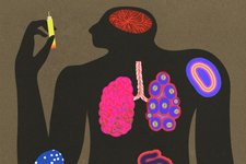 Thumbnail of Opinion | This Is What a Miracle Drug Looks Like, and It Costs Only $5 to Make
