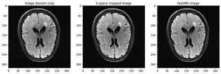 Thumbnail of Visualising MRI data in Python