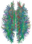 Thumbnail of Connectome - Wikipedia