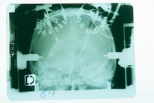 Thumbnail of Comment lire et stimuler le cerveau devient accessible à tous… pour le meilleur et pour le pire