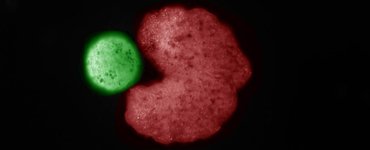 Thumbnail of Bizarre Creatures Are World's First Self-Replicating 'Living Robots', Scientists Say