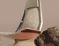Thumbnail of Martina Claesson - CONCEPT - CAR SEAT