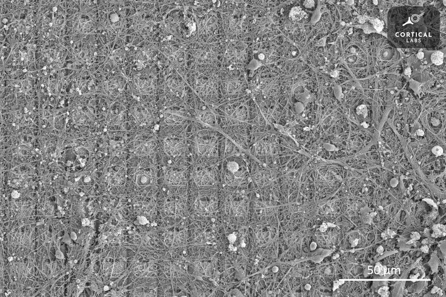 Thumbnail of Inventor ponders ethics of wiring human brain tissue into computers