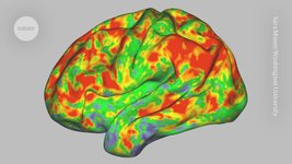 Thumbnail of Your brain on shrooms — how psilocybin resets neural networks