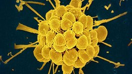 Thumbnail of FDA approves first new antibiotics to treat gonorrhea in decades, with hope to combat drug resistance | CNN | Aleks Engel | 13 comments