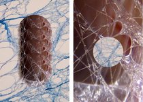 Thumbnail of Fascia: The Body’s Bridge Between Trauma and Transformation